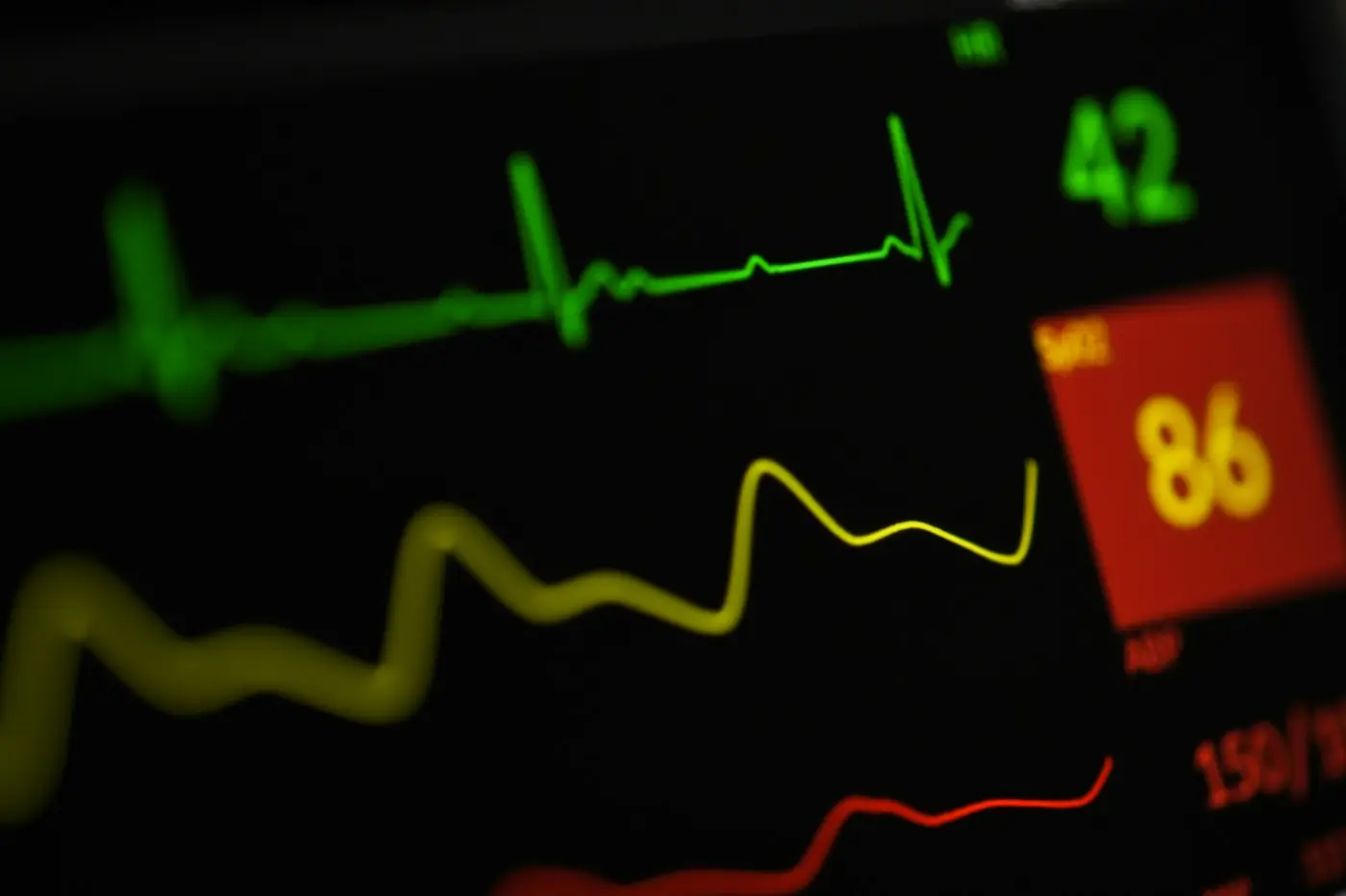 Écran de moniteur médical affichant un tracé cardiaque